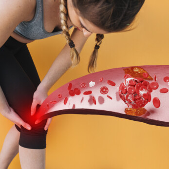 Ateroskleroza collage-person-suffering-from-blood-clot Ateroskleroza